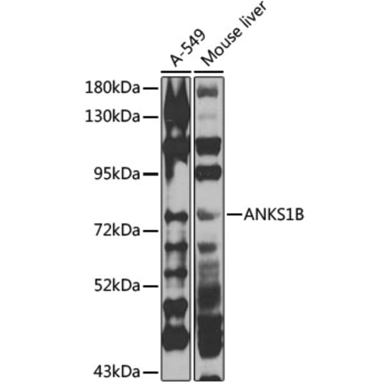 Western Blot - Anti-ANKS1B Antibody (A15915) - Antibodies.com
