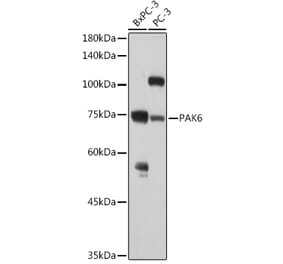 Western Blot - Anti-PAK6 Antibody (A15916) - Antibodies.com