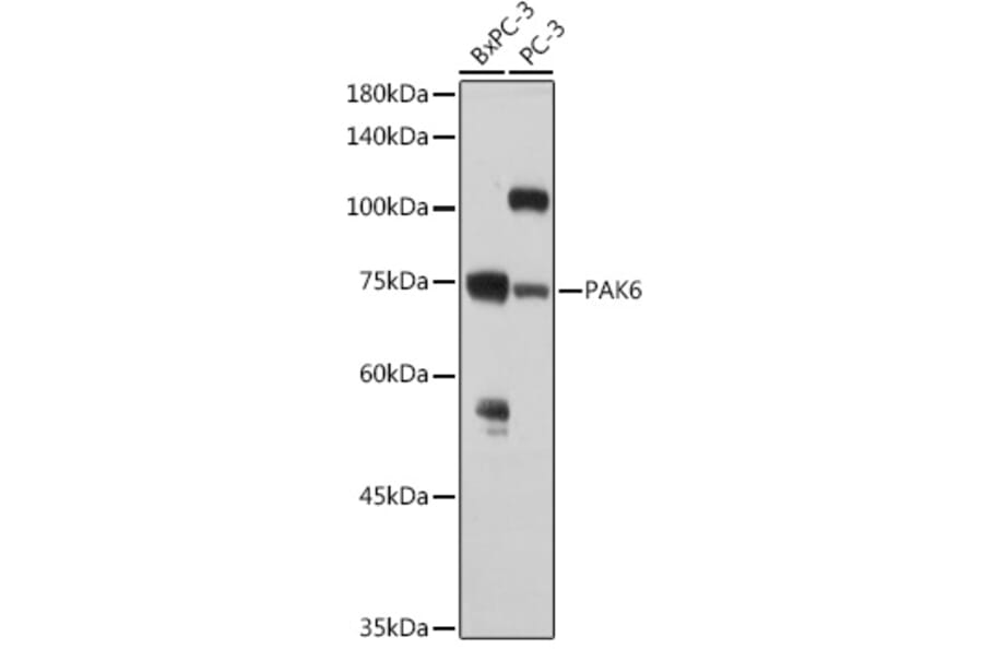 Western Blot - Anti-PAK6 Antibody (A15916) - Antibodies.com
