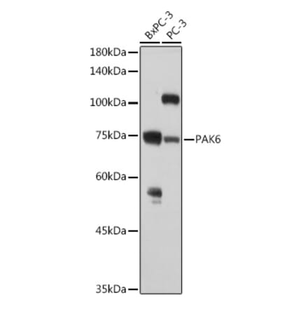 Western Blot - Anti-PAK6 Antibody (A15916) - Antibodies.com