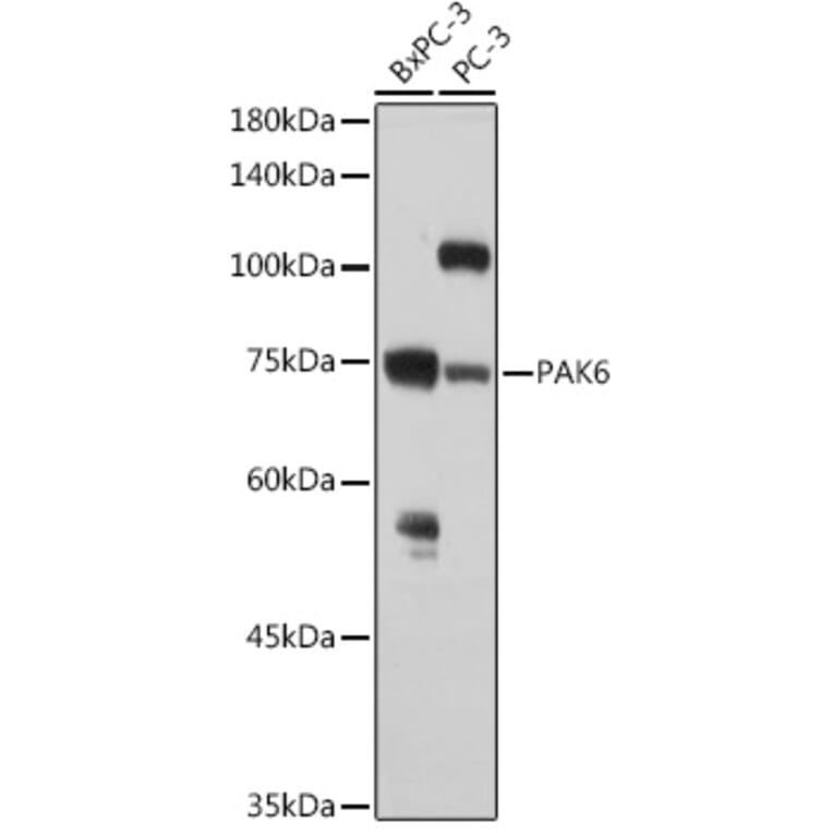 Western Blot - Anti-PAK6 Antibody (A15916) - Antibodies.com