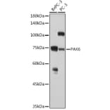 Western Blot - Anti-PAK6 Antibody (A15916) - Antibodies.com