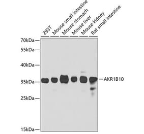 Western Blot - Anti-AKR1B10 Antibody (A15917) - Antibodies.com