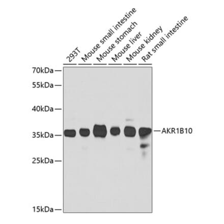 Western Blot - Anti-AKR1B10 Antibody (A15917) - Antibodies.com