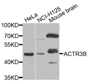 Western Blot - Anti-ACTR3B Antibody (A7824) - Antibodies.com