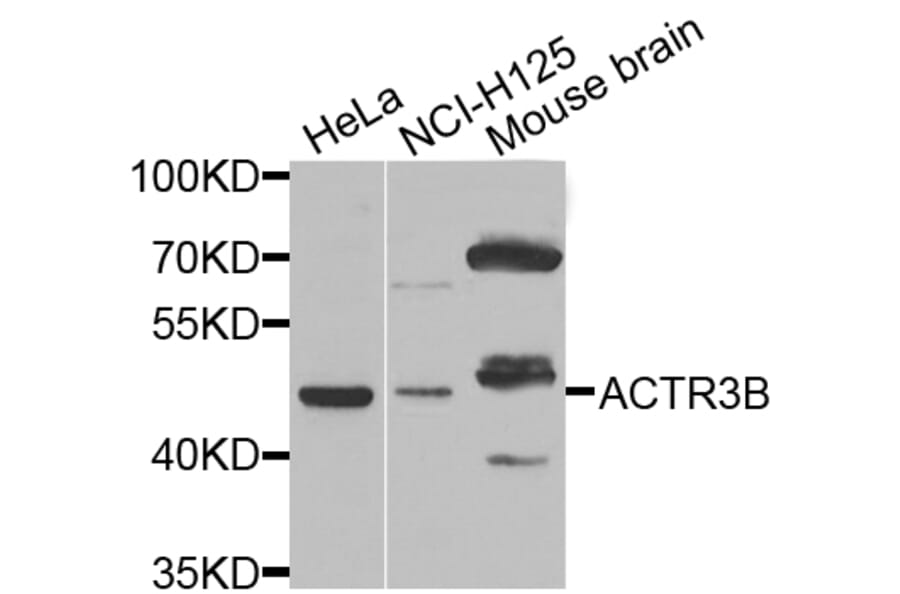 Western Blot - Anti-ACTR3B Antibody (A7824) - Antibodies.com
