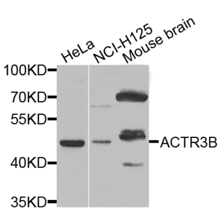 Western Blot - Anti-ACTR3B Antibody (A7824) - Antibodies.com