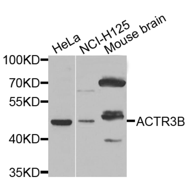 Western Blot - Anti-ACTR3B Antibody (A7824) - Antibodies.com