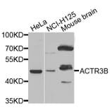 Western Blot - Anti-ACTR3B Antibody (A7824) - Antibodies.com