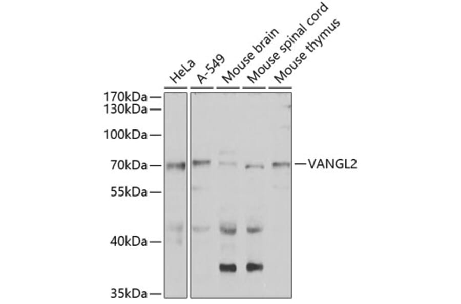 Western Blot - Anti-VANGL2 Antibody (A15919) - Antibodies.com