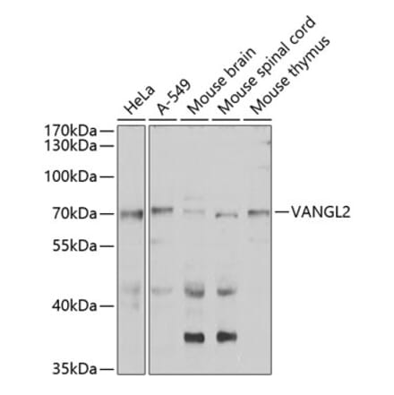 Western Blot - Anti-VANGL2 Antibody (A15919) - Antibodies.com