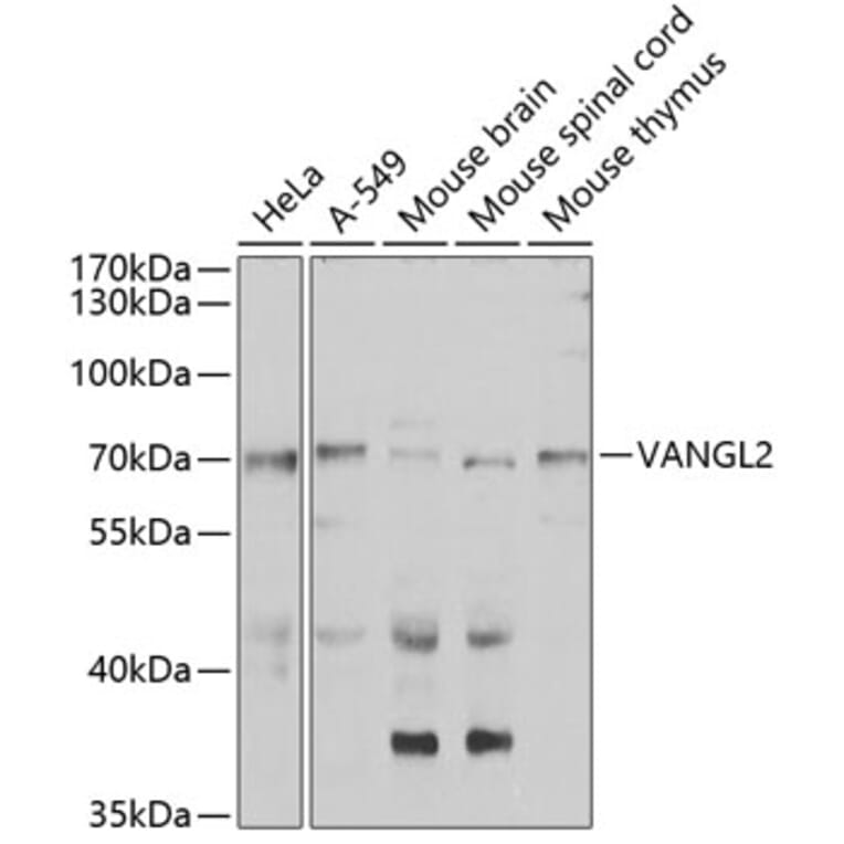 Western Blot - Anti-VANGL2 Antibody (A15919) - Antibodies.com
