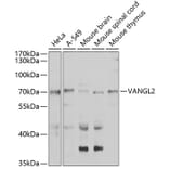 Western Blot - Anti-VANGL2 Antibody (A15919) - Antibodies.com