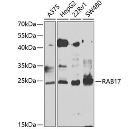 Western Blot - Anti-Rab17 Antibody (A15920) - Antibodies.com