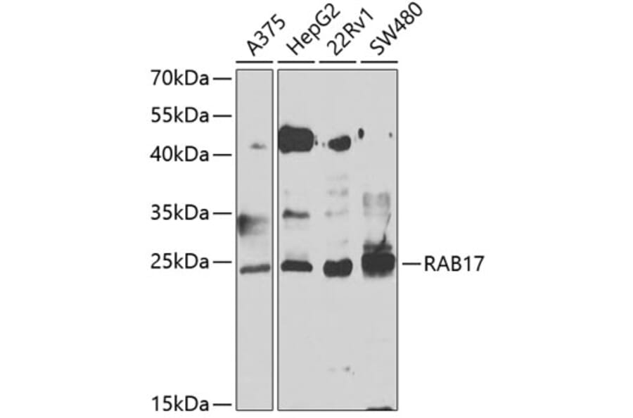 Western Blot - Anti-Rab17 Antibody (A15920) - Antibodies.com