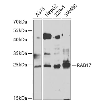 Western Blot - Anti-Rab17 Antibody (A15920) - Antibodies.com