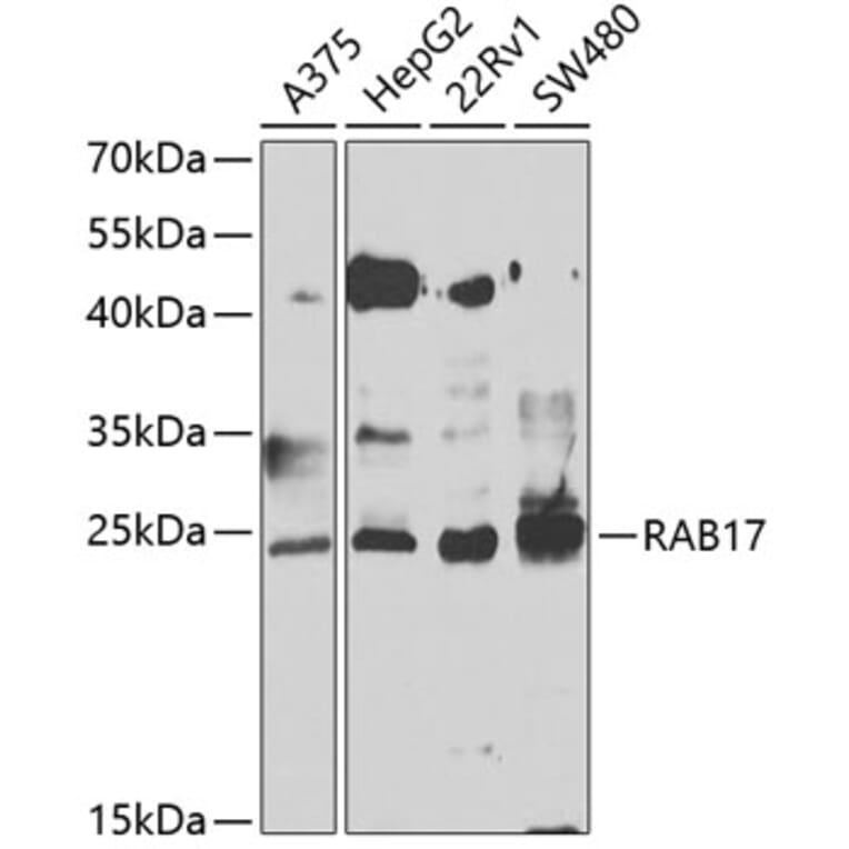 Western Blot - Anti-Rab17 Antibody (A15920) - Antibodies.com