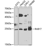 Western Blot - Anti-Rab17 Antibody (A15920) - Antibodies.com