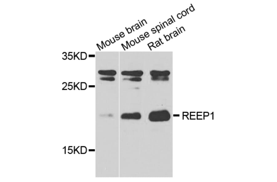 Western Blot - Anti-REEP1 Antibody (A7832) - Antibodies.com