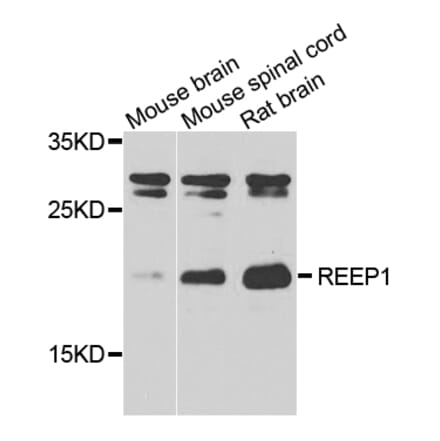 Western Blot - Anti-REEP1 Antibody (A7832) - Antibodies.com