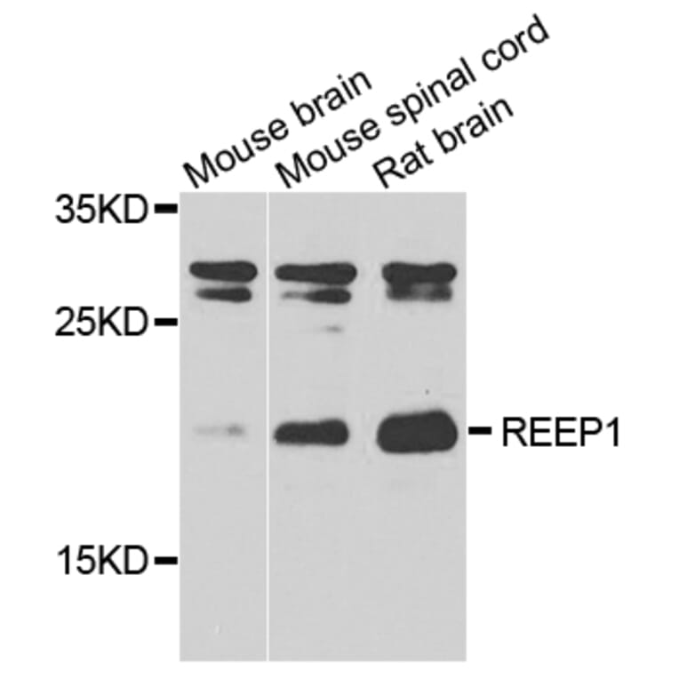 Western Blot - Anti-REEP1 Antibody (A7832) - Antibodies.com