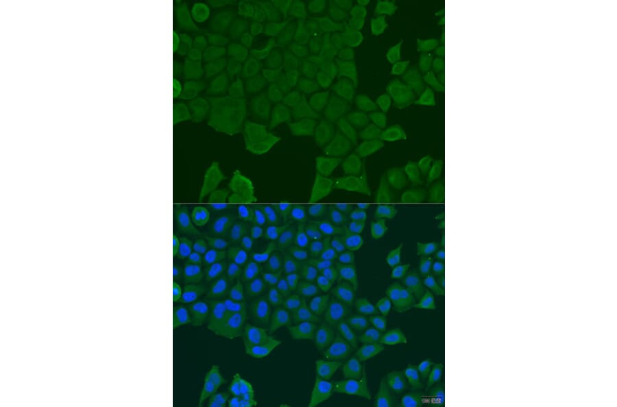 Immunofluorescence - Anti-REEP1 Antibody (A7832) - Antibodies.com