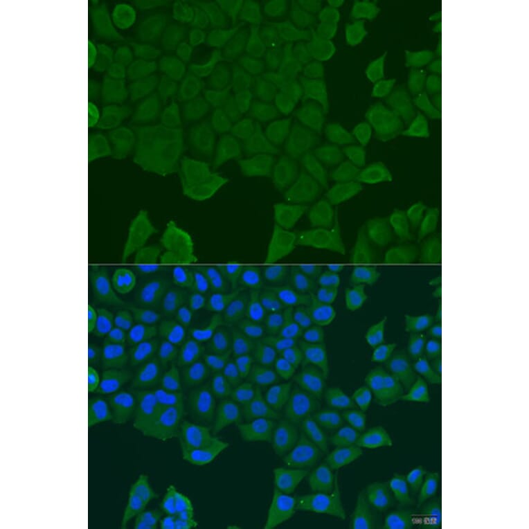 Immunofluorescence - Anti-REEP1 Antibody (A7832) - Antibodies.com