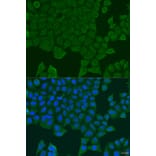 Immunofluorescence - Anti-REEP1 Antibody (A7832) - Antibodies.com
