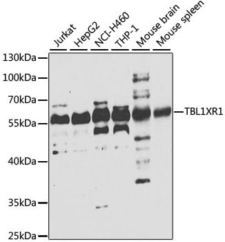 Western blot analysis of extracts of various cell lines, using Anti-TBL1XR1 Antibody (A7834) at 1:1,000 dilution.
Secondary antibody: Goat Anti-Rabbit IgG (H+L) (HRP) (AS014) at 1:10,000 dilution.
Lysates / proteins: 25µg per lane.
Blocking buffer: 3% non-fat dry milk in TBST.
Detection: ECL Basic Kit (RM00020).
Exposure time: 10s.