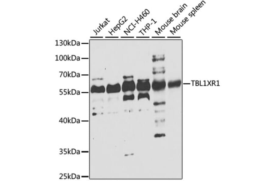 Western Blot - Anti-TBLR1/TBL1XR1 Antibody (A15922) - Antibodies.com