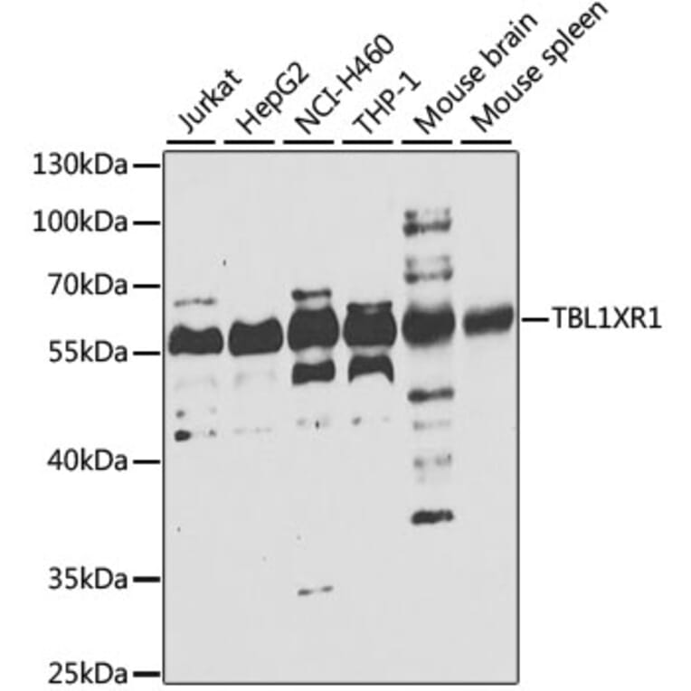 Western Blot - Anti-TBLR1/TBL1XR1 Antibody (A15922) - Antibodies.com