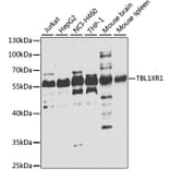 Western Blot - Anti-TBLR1/TBL1XR1 Antibody (A15922) - Antibodies.com