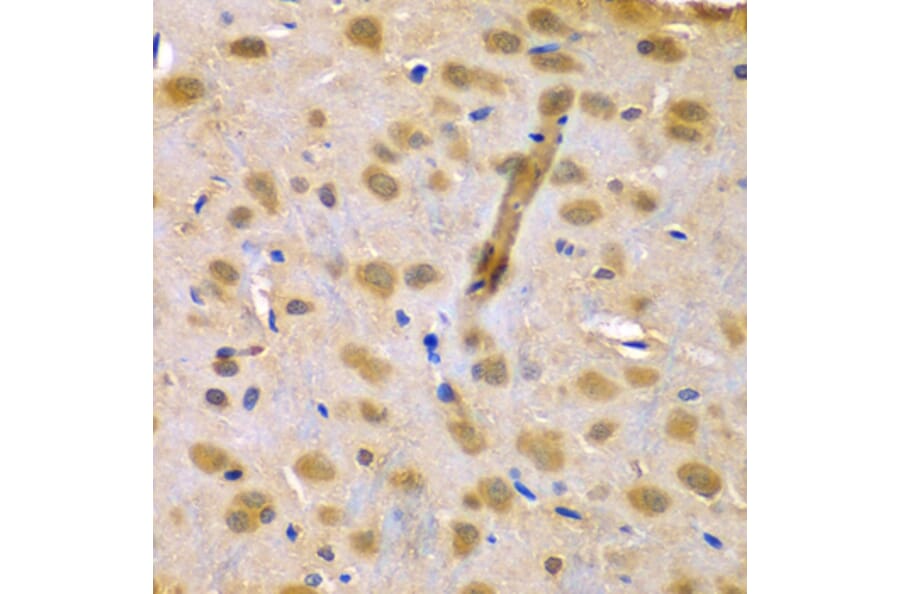 Immunohistochemistry - Anti-RUFY1 Antibody (A7836) - Antibodies.com