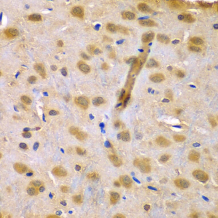 Immunohistochemistry - Anti-RUFY1 Antibody (A7836) - Antibodies.com