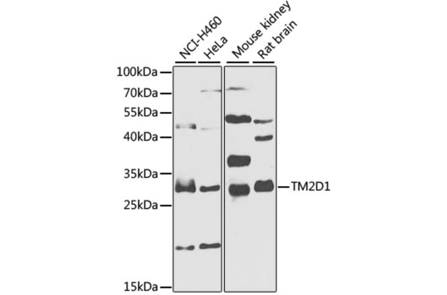 Western Blot - Anti-TM2D1 Antibody (A7840) - Antibodies.com