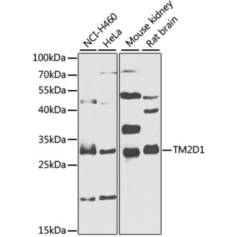 Western Blot - Anti-TM2D1 Antibody (A7840) - Antibodies.com