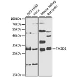 Western Blot - Anti-TM2D1 Antibody (A7840) - Antibodies.com