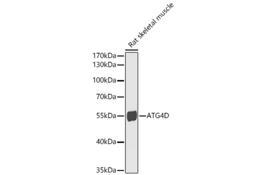 Western Blot - Anti-ATG4D Antibody (A15926) - Antibodies.com