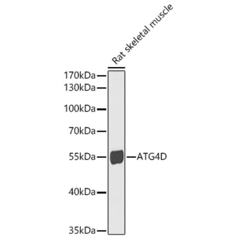 Western Blot - Anti-ATG4D Antibody (A15926) - Antibodies.com