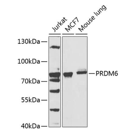 Western Blot - Anti-PRDM6 Antibody (A15928) - Antibodies.com