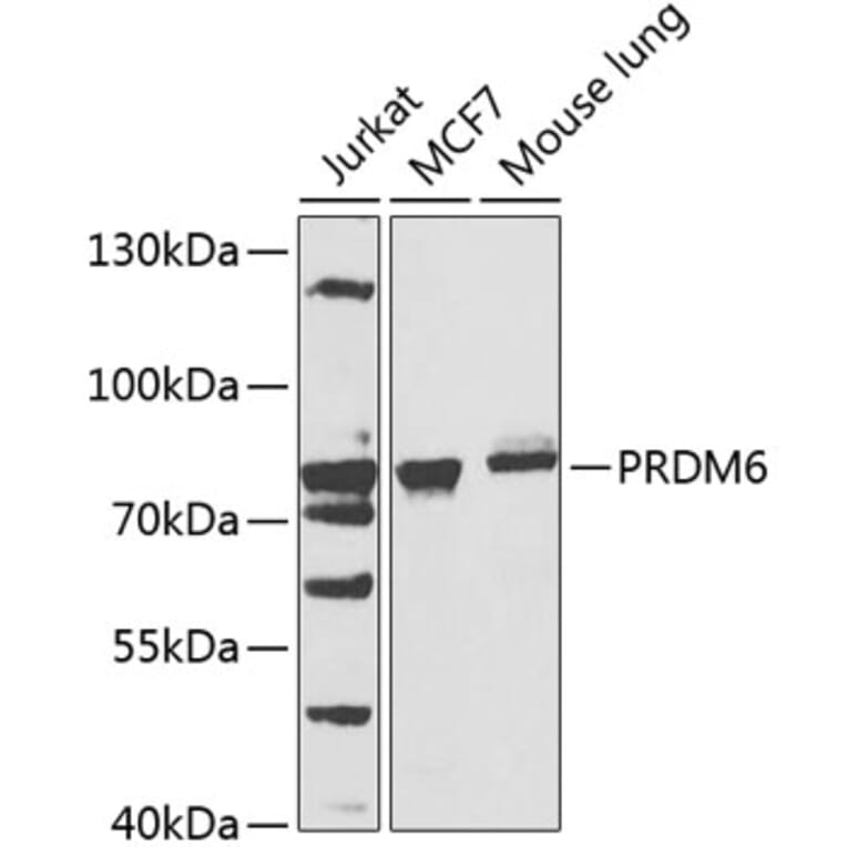Western Blot - Anti-PRDM6 Antibody (A15928) - Antibodies.com