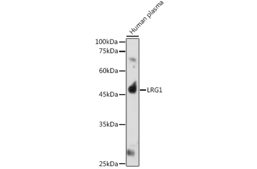Western Blot - Anti-LRG1/LRG Antibody (A15929) - Antibodies.com