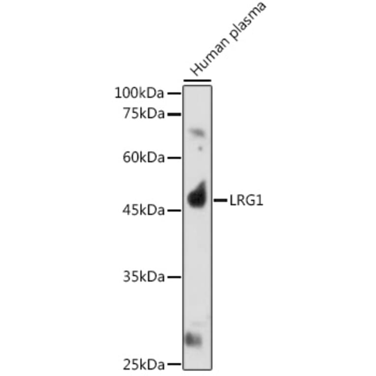 Western Blot - Anti-LRG1/LRG Antibody (A15929) - Antibodies.com