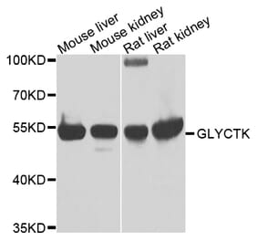 Western Blot - Anti-GLYCTK Antibody (A15948) - Antibodies.com