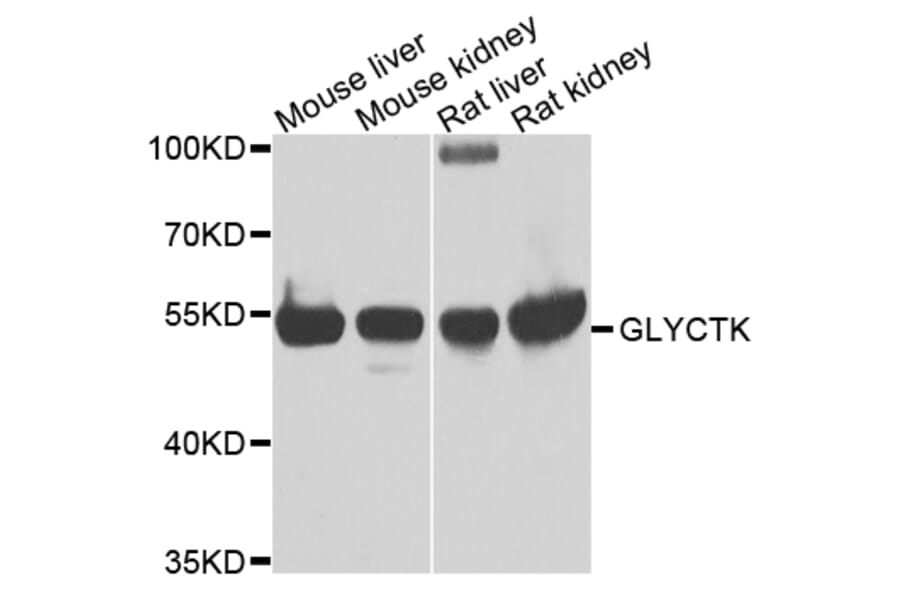 Western Blot - Anti-GLYCTK Antibody (A7852) - Antibodies.com