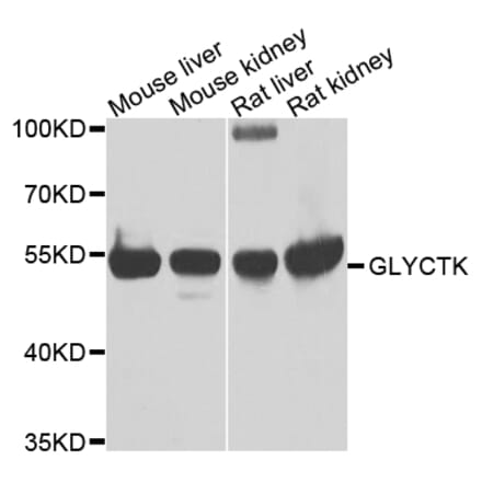 Western Blot - Anti-GLYCTK Antibody (A15948) - Antibodies.com