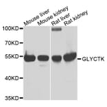 Western Blot - Anti-GLYCTK Antibody (A7852) - Antibodies.com