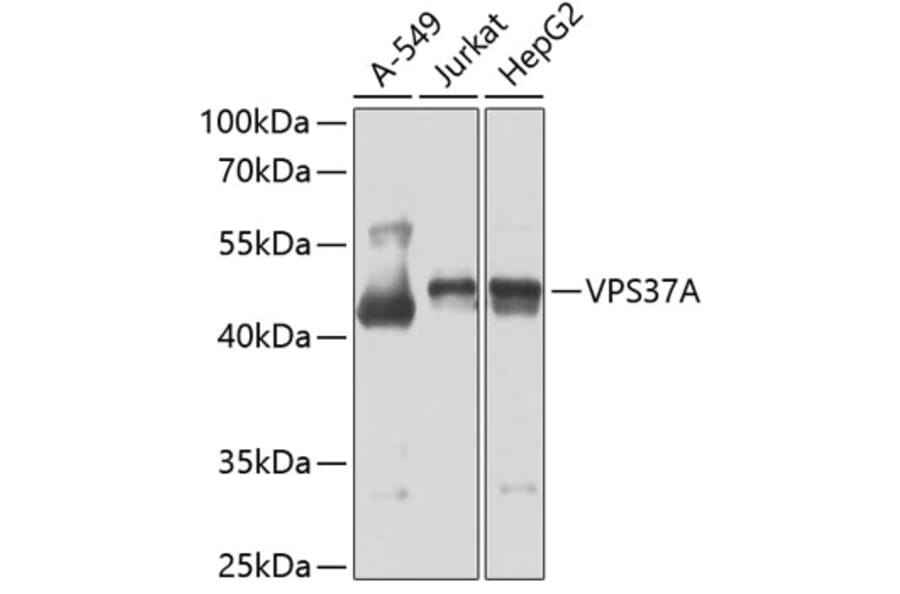 Western Blot - Anti-VPS37A/HCRP1 Antibody (A15931) - Antibodies.com