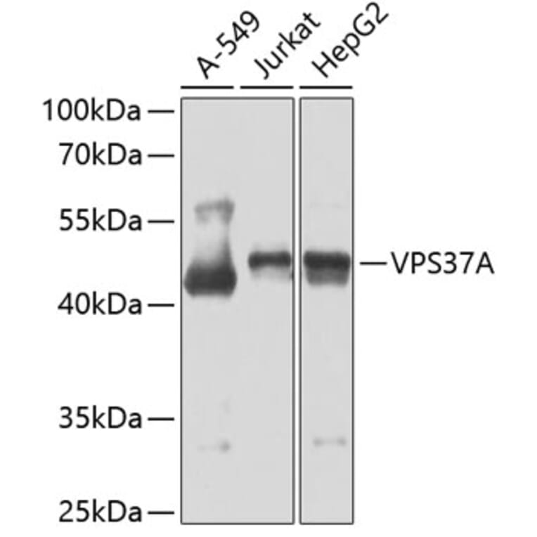 Western Blot - Anti-VPS37A/HCRP1 Antibody (A15931) - Antibodies.com