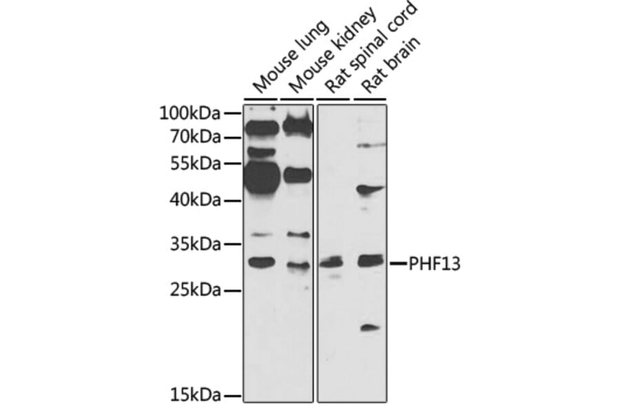 Western Blot - Anti-PHF13 Antibody (A7854) - Antibodies.com